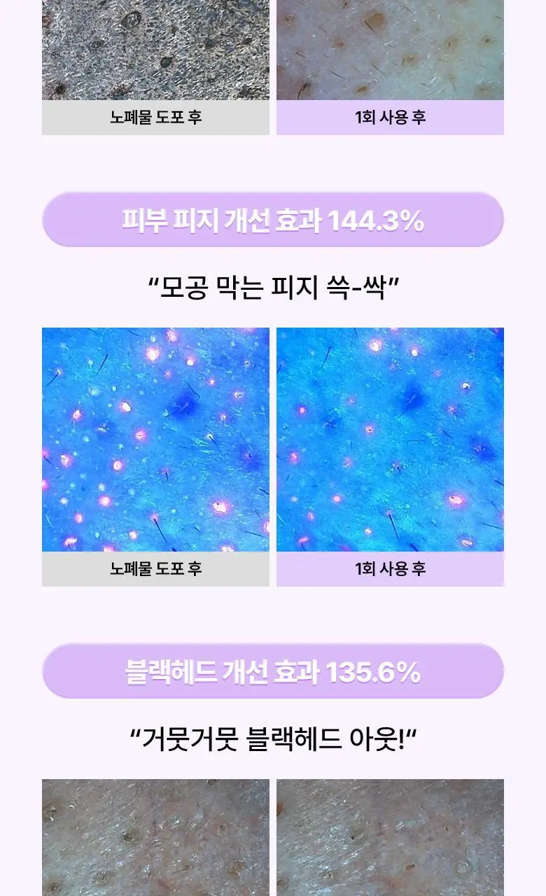 [모공딥클렌징] 바이오힐보 프로바이오덤 콜라겐 리모델링 딥 클렌징 밤 100mL 상세페이지 11